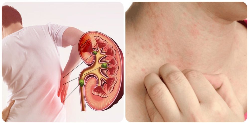 nhóm đối tượng sử dụng chế phẩm nhàu